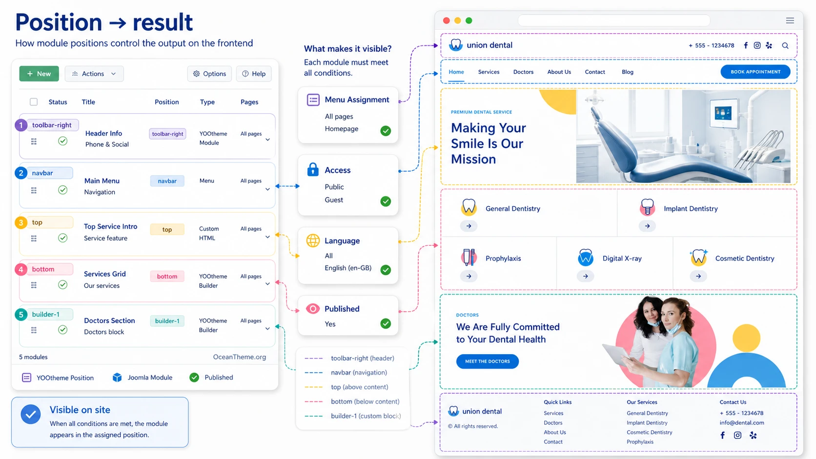 How menus, modules, and public output connect in the Union Dental Joomla template